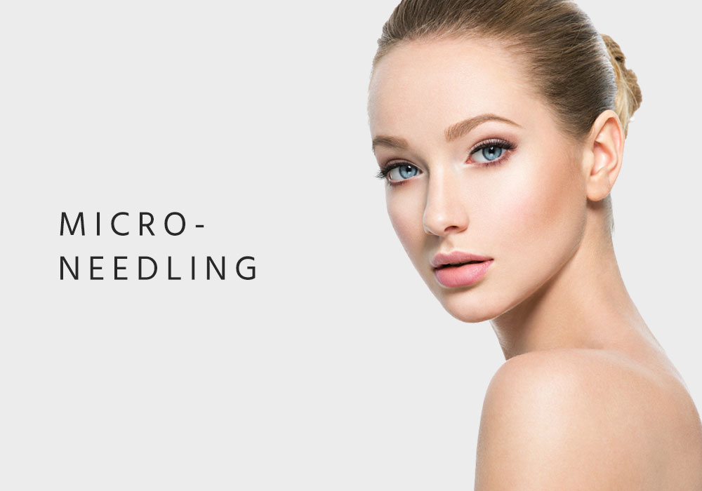 Micro-Needling