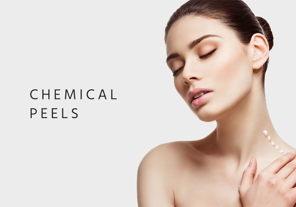 Chemical Peels