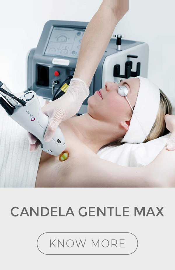 Candela Gentle Max