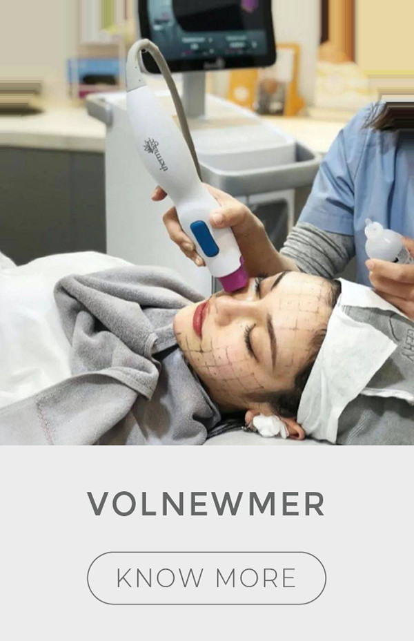 Volnewmer